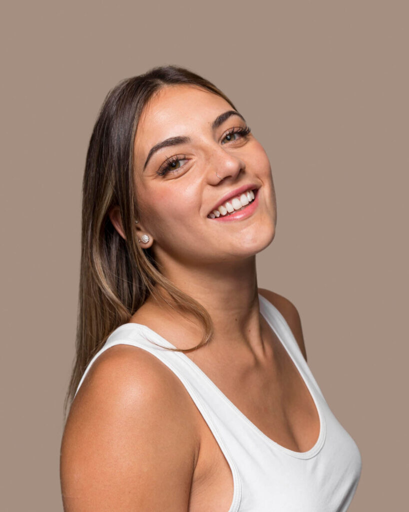 Facetas em Resina sao bento do sul
